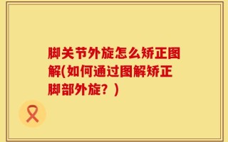 脚关节外旋怎么矫正图解(如何通过图解矫正脚部外旋？)
