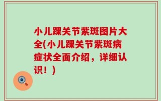 小儿踝关节紫斑图片大全(小儿踝关节紫斑病症状全面介绍，详细认识！)