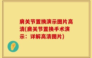 肩关节置换演示图片高清(肩关节置换手术演示：详解高清图片)