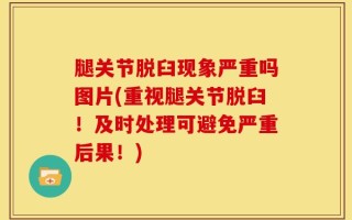 腿关节脱臼现象严重吗图片(重视腿关节脱臼！及时处理可避免严重后果！)