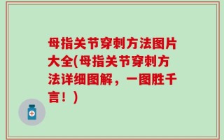 母指关节穿刺方法图片大全(母指关节穿刺方法详细图解，一图胜千言！)