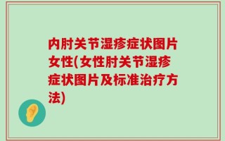内肘关节湿疹症状图片女性(女性肘关节湿疹症状图片及标准治疗方法)