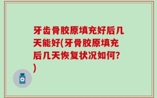 牙齿骨胶原填充好后几天能好(牙骨胶原填充后几天恢复状况如何？)