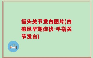 指头关节发白图片(白癜风早期症状-手指关节发白)