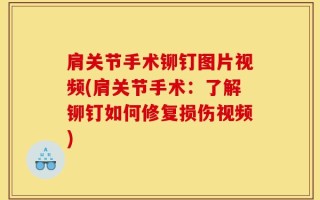 肩关节手术铆钉图片视频(肩关节手术：了解铆钉如何修复损伤视频)