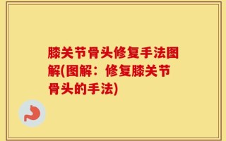 膝关节骨头修复手法图解(图解：修复膝关节骨头的手法)