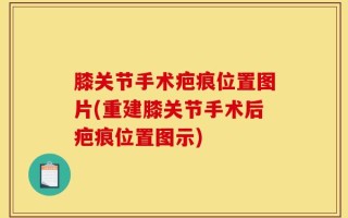 膝关节手术疤痕位置图片(重建膝关节手术后疤痕位置图示)
