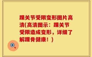 踝关节受限变形图片高清(高清图示：踝关节受限造成变形，详细了解踝骨健康！)