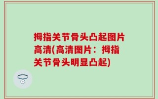 拇指关节骨头凸起图片高清(高清图片：拇指关节骨头明显凸起)