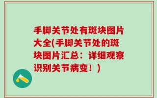 手脚关节处有斑块图片大全(手脚关节处的斑块图片汇总：详细观察识别关节病变！)