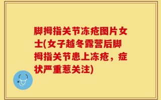 脚拇指关节冻疮图片女士(女子越冬露营后脚拇指关节患上冻疮，症状严重惹关注)