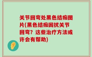 关节回弯处黑色结痂图片(黑色结痂困扰关节回弯？这些治疗方法或许会有帮助)