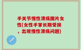 手关节慢性溃疡图片女性(女性手掌长期受损，出现慢性溃疡问题)