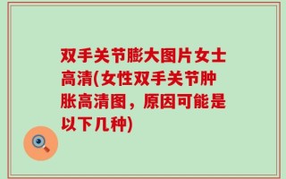 双手关节膨大图片女士高清(女性双手关节肿胀高清图，原因可能是以下几种)