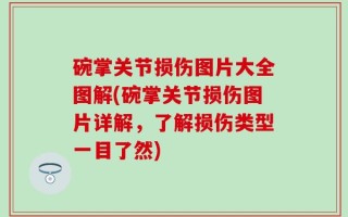 碗掌关节损伤图片大全图解(碗掌关节损伤图片详解，了解损伤类型一目了然)