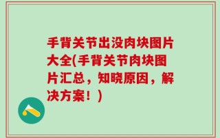 手背关节出没肉块图片大全(手背关节肉块图片汇总，知晓原因，解决方案！)