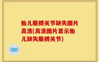 胎儿胳膊关节缺失图片高清(高清图片显示胎儿缺失胳膊关节)