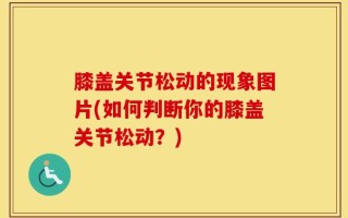 膝盖关节松动的现象图片(如何判断你的膝盖关节松动？)