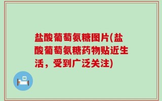 盐酸葡萄氨糖图片(盐酸葡萄氨糖药物贴近生活，受到广泛关注)