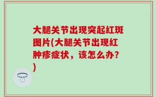 大腿关节出现突起红斑图片(大腿关节出现红肿疹症状，该怎么办？)