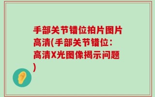 手部关节错位拍片图片高清(手部关节错位：高清X光图像揭示问题)