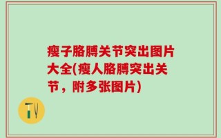瘦子胳膊关节突出图片大全(瘦人胳膊突出关节，附多张图片)
