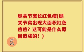 腿关节窝长红色痘(腿关节窝出现大面积红色痘痘？这可能是什么原因造成的！)