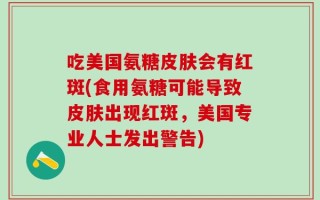 吃美国氨糖皮肤会有红斑(食用氨糖可能导致皮肤出现红斑，美国专业人士发出警告)