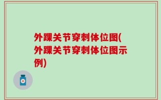 外踝关节穿刺体位图(外踝关节穿刺体位图示例)