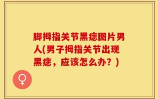 脚拇指关节黑痣图片男人(男子拇指关节出现黑痣，应该怎么办？)