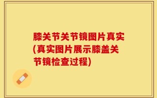 膝关节关节镜图片真实(真实图片展示膝盖关节镜检查过程)