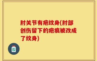 肘关节有疤纹身(肘部创伤留下的疤痕被改成了纹身)