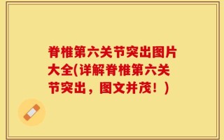 脊椎第六关节突出图片大全(详解脊椎第六关节突出，图文并茂！)
