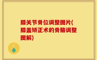 膝关节骨位调整图片(膝盖矫正术的骨骼调整图解)