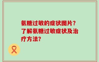 氨糖过敏的症状图片？了解氨糖过敏症状及治疗方法？