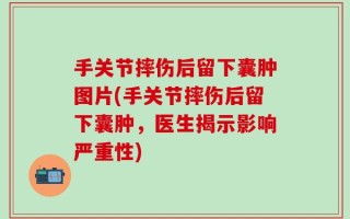 手关节摔伤后留下囊肿图片(手关节摔伤后留下囊肿，医生揭示影响严重性)