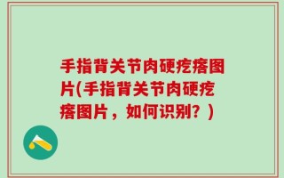 手指背关节肉硬疙瘩图片(手指背关节肉硬疙瘩图片，如何识别？)