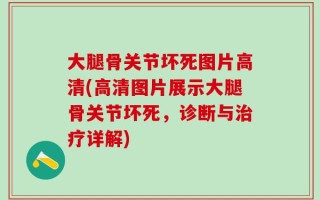 大腿骨关节坏死图片高清(高清图片展示大腿骨关节坏死，诊断与治疗详解)