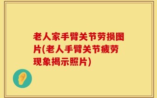 老人家手臂关节劳损图片(老人手臂关节疲劳现象揭示照片)
