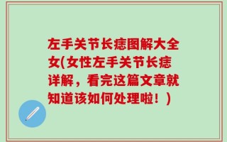 左手关节长痣图解大全女(女性左手关节长痣详解，看完这篇文章就知道该如何处理啦！)