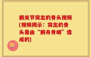 腕关节突出的骨头视频(视频揭示：突出的骨头是由“腕舟骨嵴”造成的)