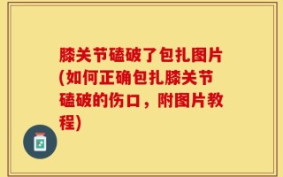 膝关节磕破了包扎图片(如何正确包扎膝关节磕破的伤口，附图片教程)