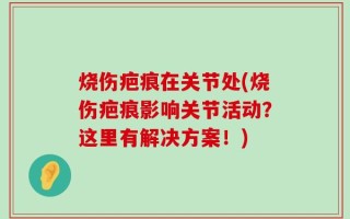 烧伤疤痕在关节处(烧伤疤痕影响关节活动？这里有解决方案！)