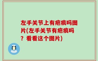 左手关节上有疤痕吗图片(左手关节有疤痕吗？看看这个图片)