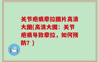 关节疤痕牵拉图片高清大图(高清大图：关节疤痕导致牵拉，如何预防？)