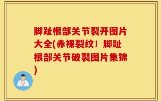 脚趾根部关节裂开图片大全(赤裸裂纹！脚趾根部关节破裂图片集锦)