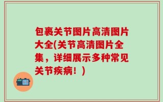 包裹关节图片高清图片大全(关节高清图片全集，详细展示多种常见关节疾病！)
