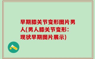 早期膝关节变形图片男人(男人膝关节变形：现状早期图片展示)