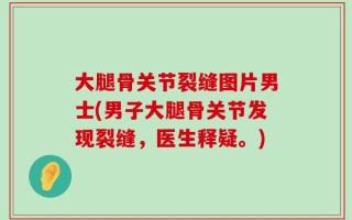 大腿骨关节裂缝图片男士(男子大腿骨关节发现裂缝，医生释疑。)