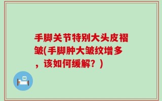 手脚关节特别大头皮褶皱(手脚肿大皱纹增多，该如何缓解？)